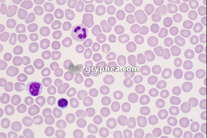 Sang humain x250 - gryphea.com